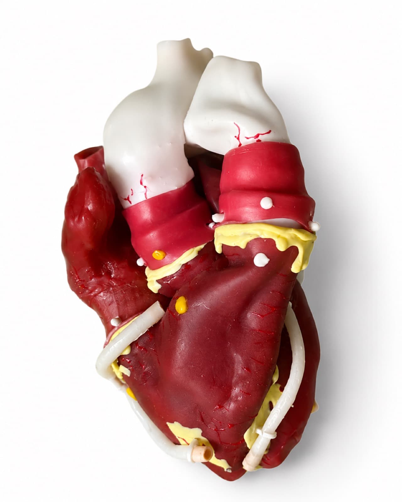 Simulador de Reemplazo Valvular y Revascularización Coronaria