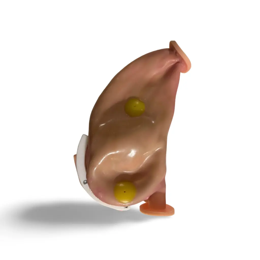 estomago_flexible_con_lesiones.webp