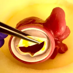 valvula-mitral-300x300.webp