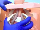 Instalación dispositivo GU en fantoma modelo GU.webp