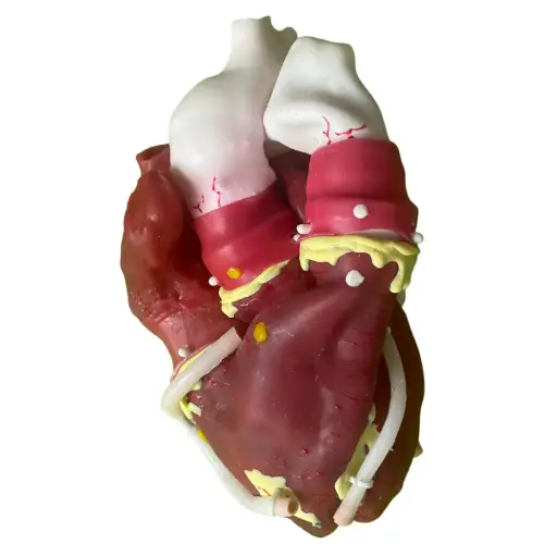 Quirúrgico de Corazón